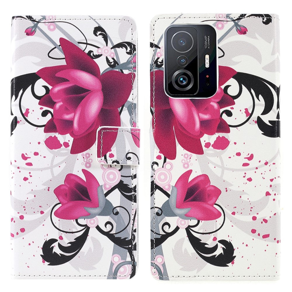 Xiaomi 11t - Handyhülle Motiv