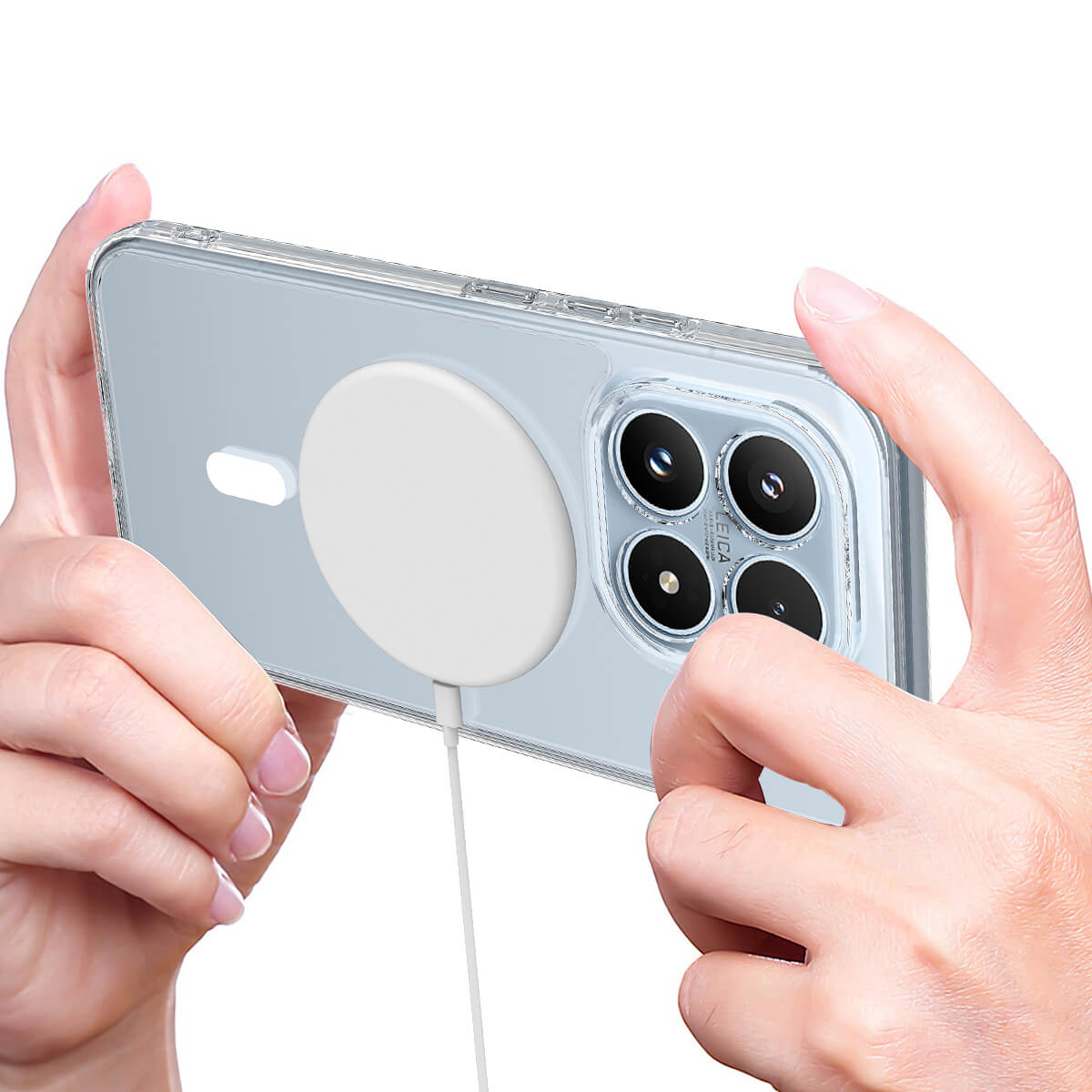 Xiaomi 17 -  Acrylic Phone Case with Magnet