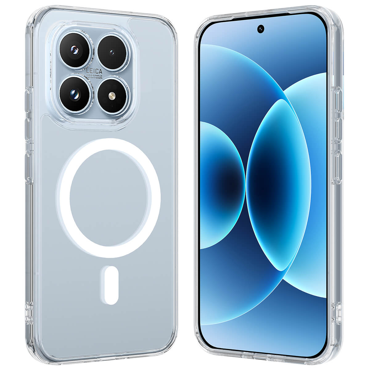 Xiaomi 17 -  Acrylic Phone Case with Magnet